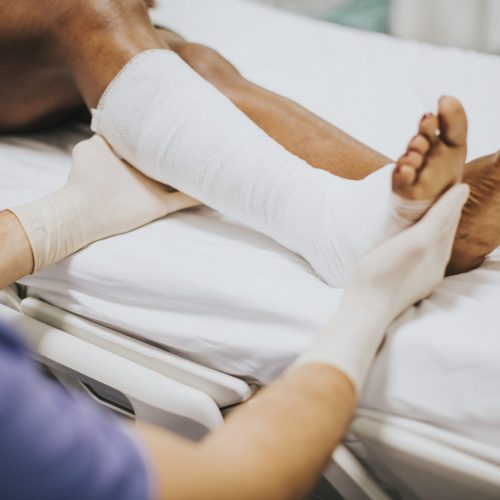 Doctor helping a patient with a fractured leg