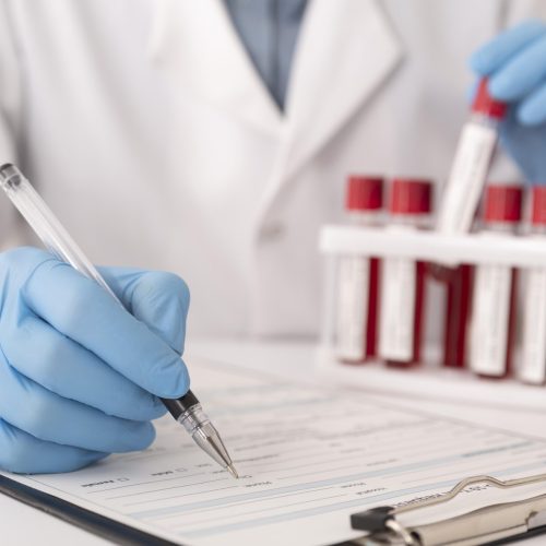 surtido-de-muestras-de-sangre-de-coronavirus-en-el-laboratorio